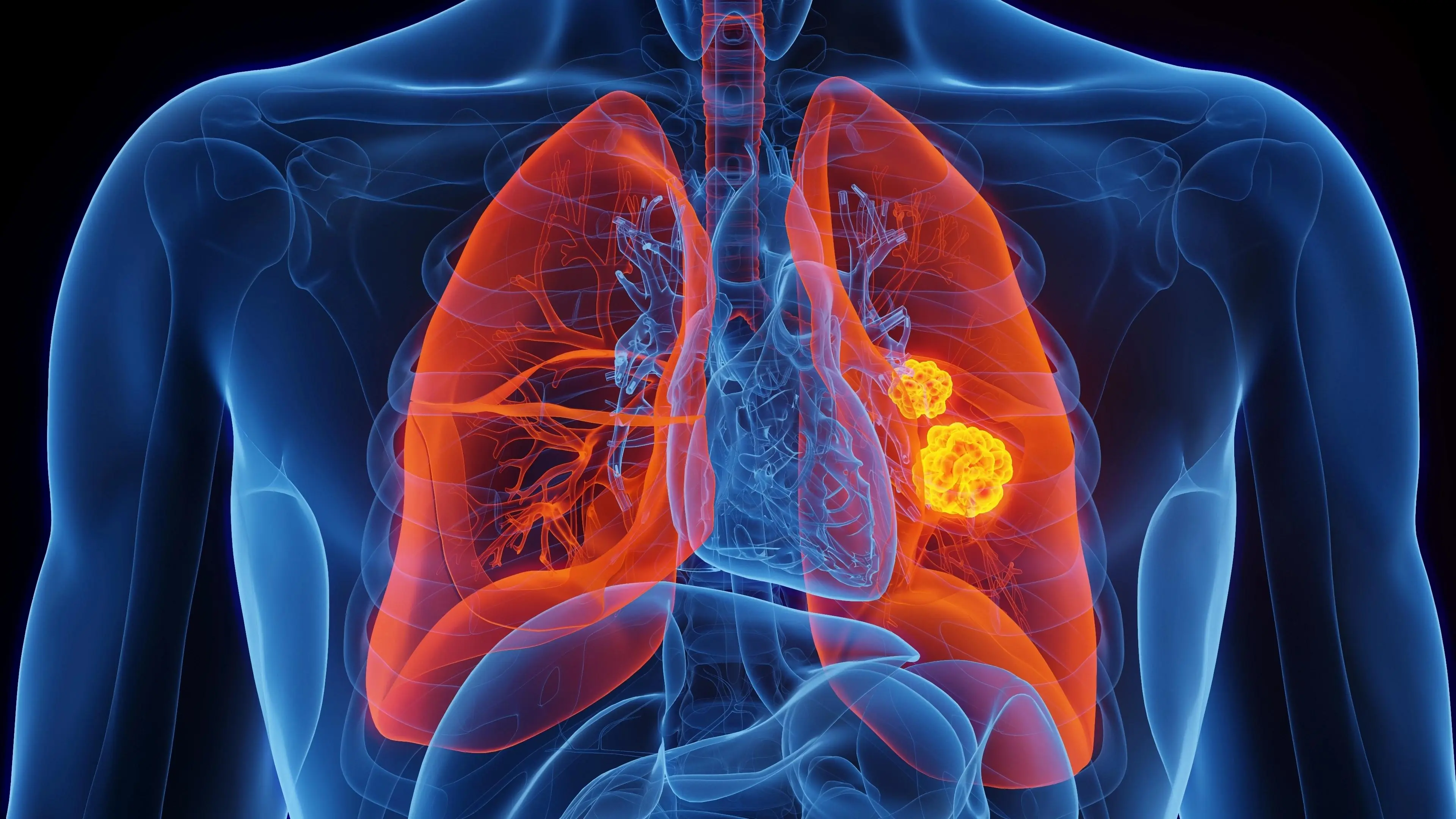 16 Early Signs Can.cer May Be Growing in Your Body: Warning Symptoms You Should Never Ignore