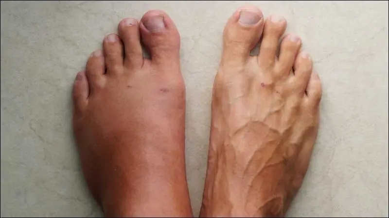 9 Essential Nutrients That May Help Support Healthy Legs and Reduce Fluid Retention