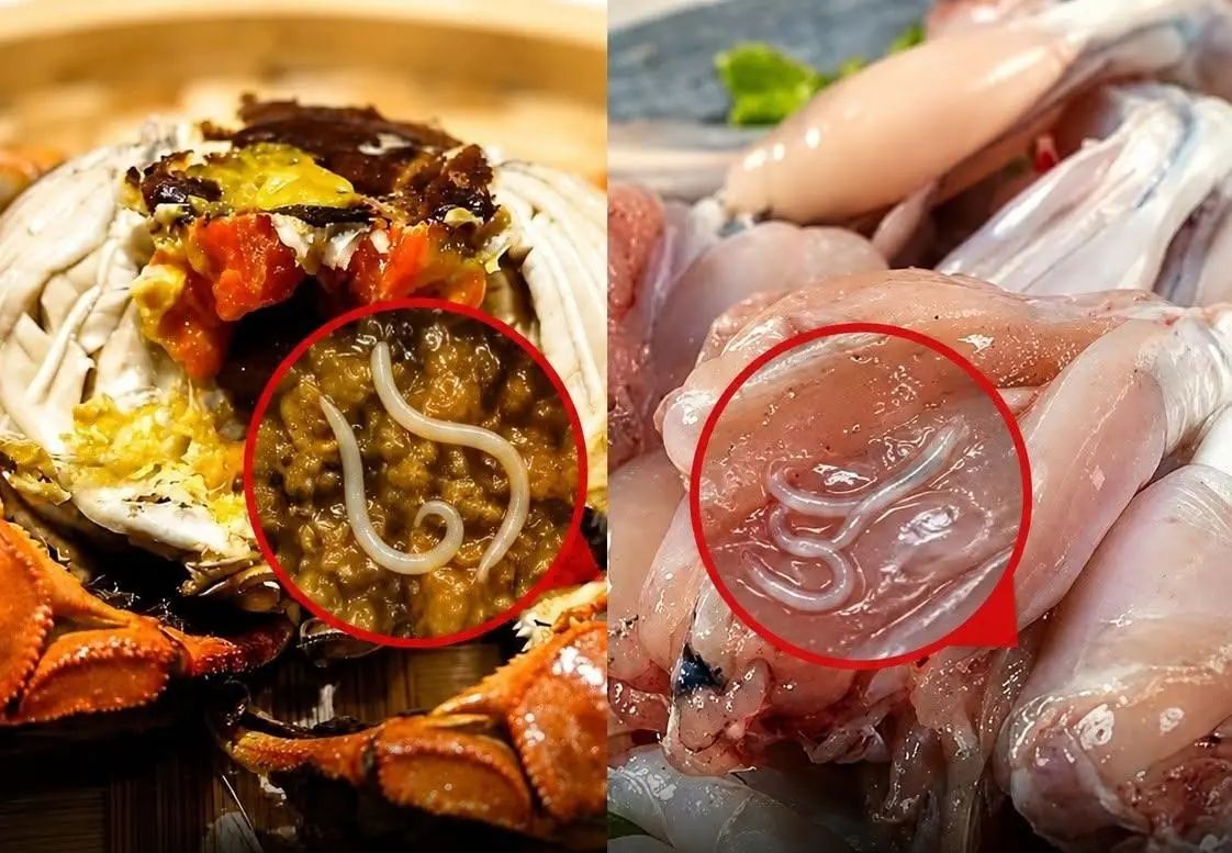 Doctors Warn: These 4 Popular Foods May Hide Dangerous Parasite