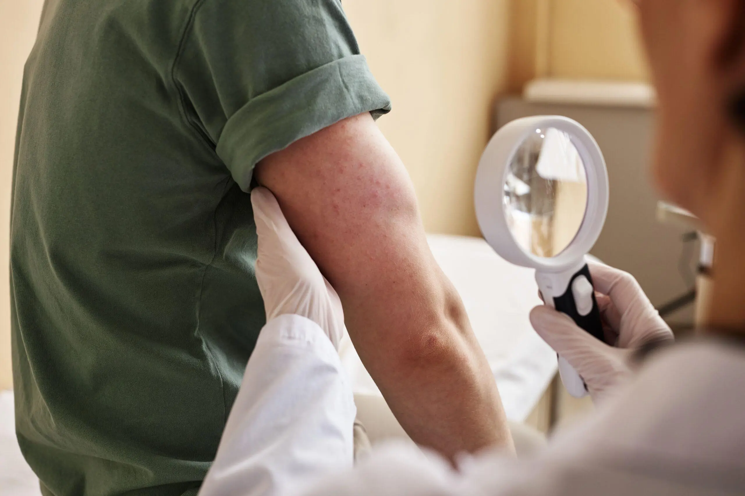 11 Skin Rashes You Should Never Ignore: They Could Be Warning Signs of Serious Health Problems