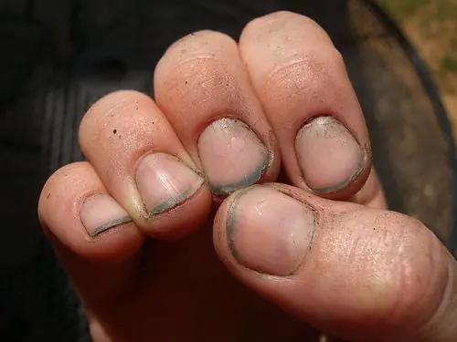 What Do Dirty Fingernails Really Say About You? The Answer May Surprise You