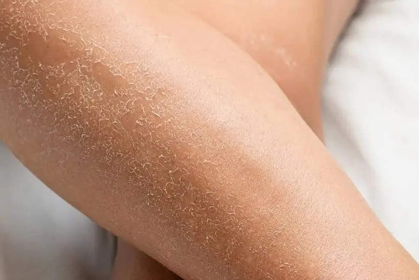 Is Your Skin Trying to Tell You Something? 10 Signs That May Point to Kidney Problems
