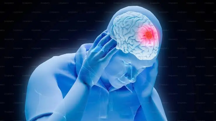 A Mini Str0ke Can Be a Serious Warning Sign - What People Over 40 Need to Know
