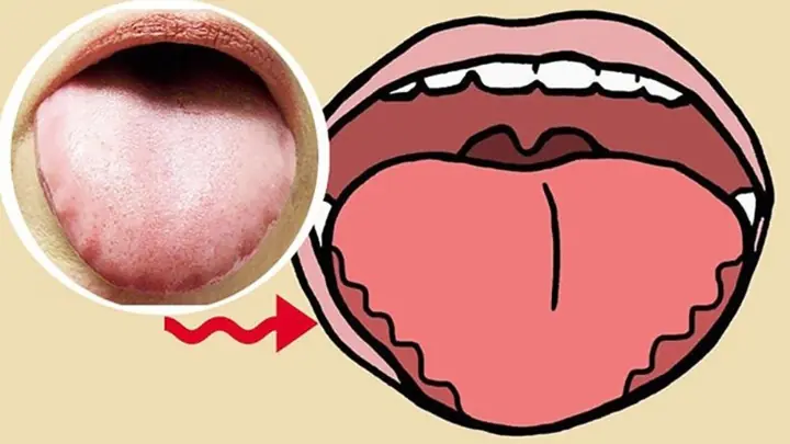 Is Your Body Missing Vitamin B12? Here Are 10 Possible Warning Signs