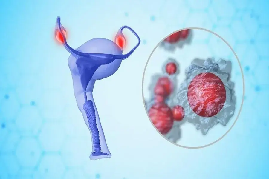 Know the Signs: 8 Possible Symptoms of Ovarian Can.cer