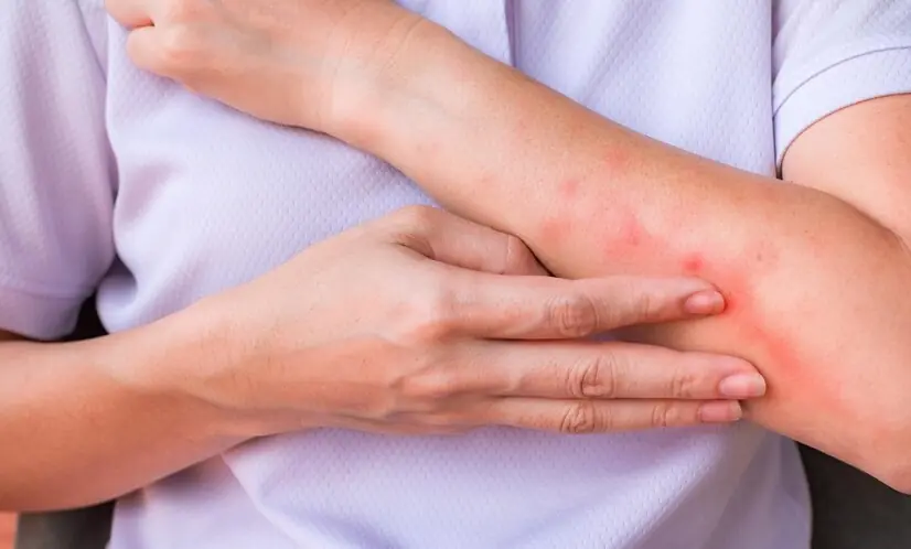 Can Sleeping With a Fan On Affect Your Skin? What the Evidence Says