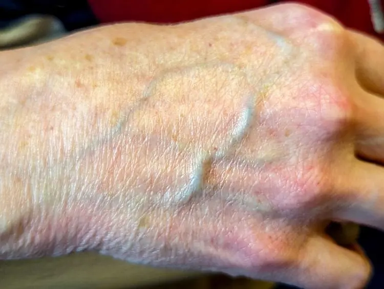 If you have visible veins, it means you are... See more 👇
