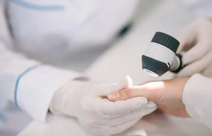 Black Spot on the Palm May Be More Than a Mole: Doctors Warn of a Rare Skin Can.cer Sign