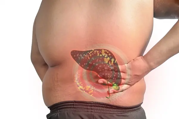 Is Your Belly Getting Bigger From Fat or Something Else? Key Signs to Know