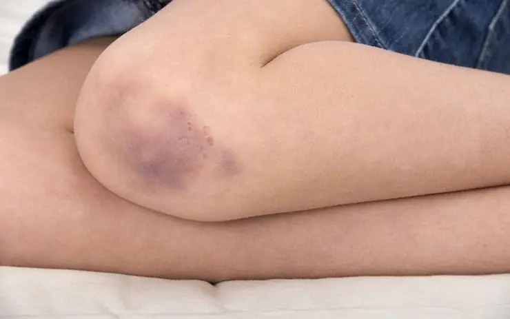 18 Signs Your Body May Be Signaling a Health Concern
