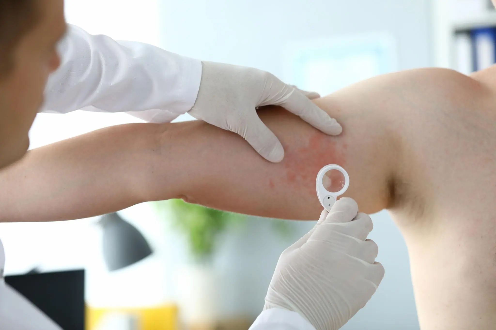 Itching at Night? Doctors Say Persistent Symptoms Shouldn’t Be Ignored