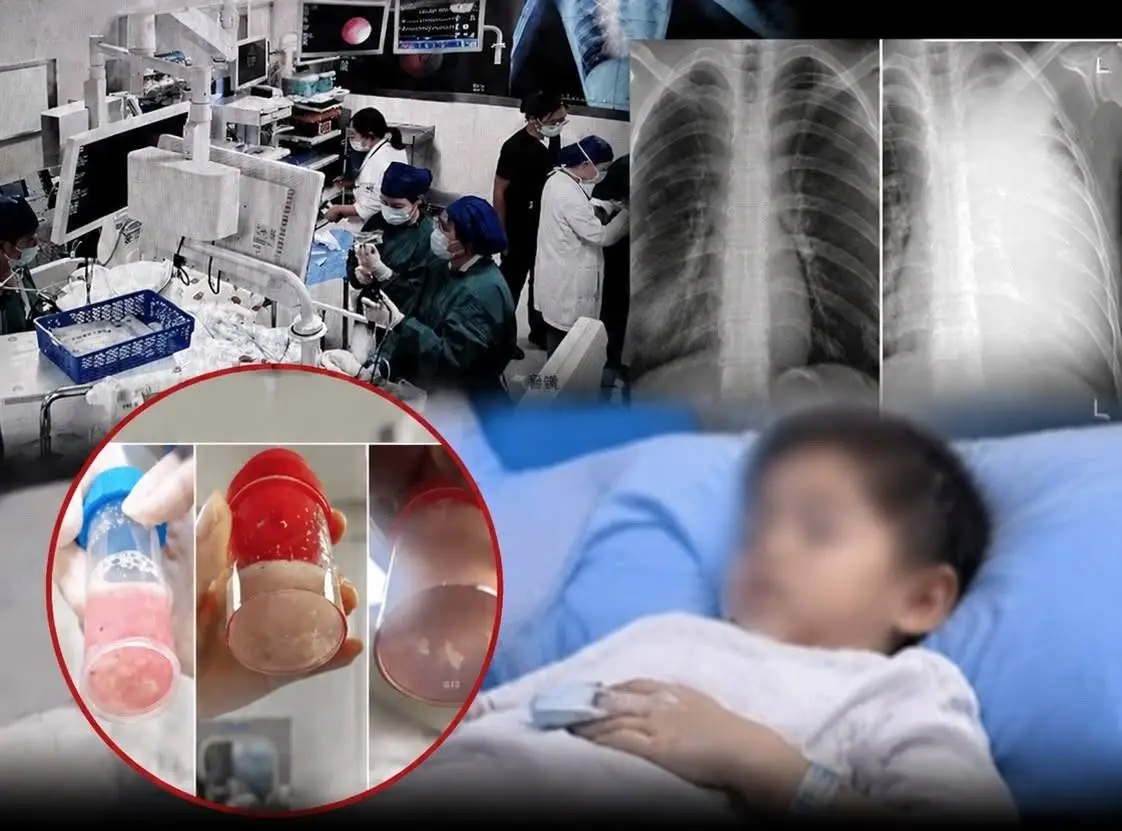 This frightening case shows how quickly a child's condition can deteriorate.