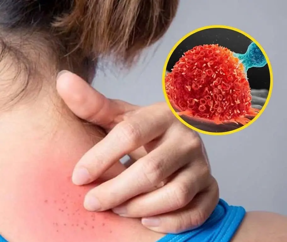 These 9 Unusual Itching Symptoms Could Be Your Body’s Way of Signaling Underlying Illness. See more in the comment..