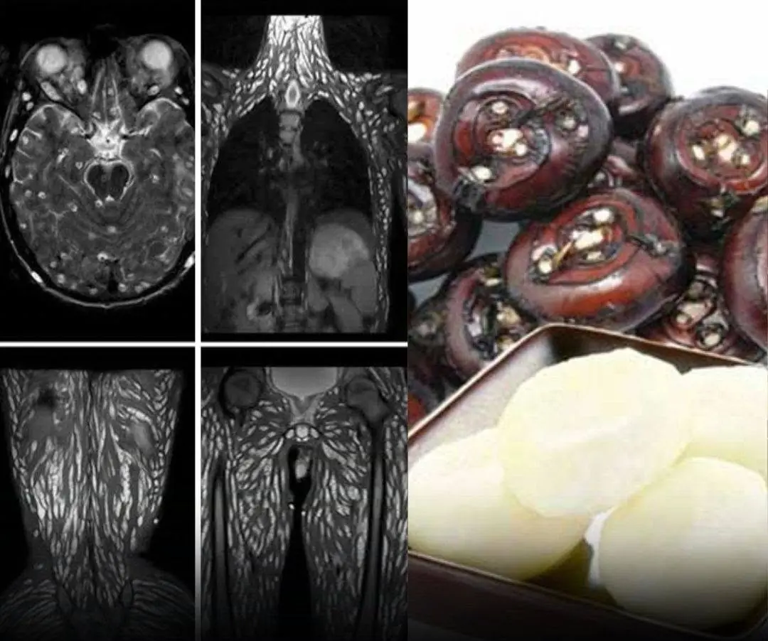 People often consume this food without knowing it could contain harmful parasites