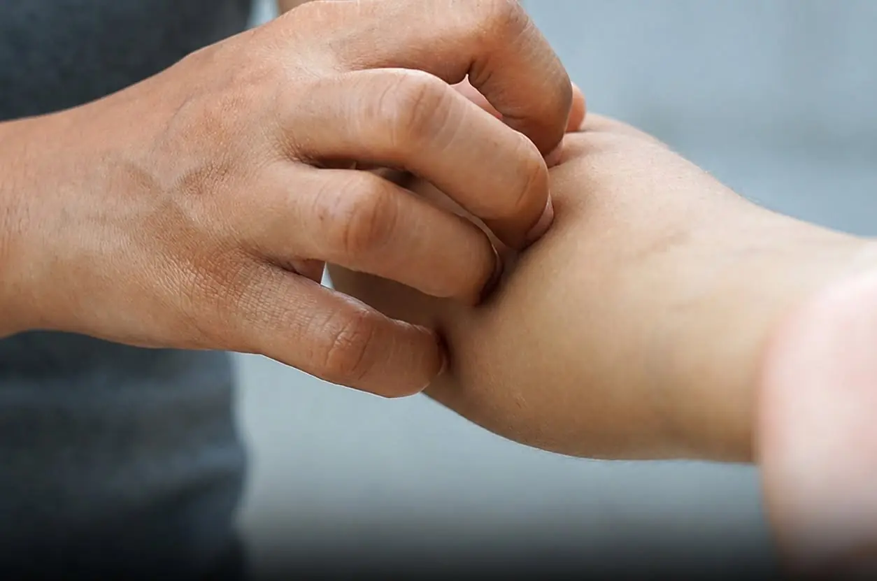 She thought it was just dry skin… until doctors gave her devastating news
