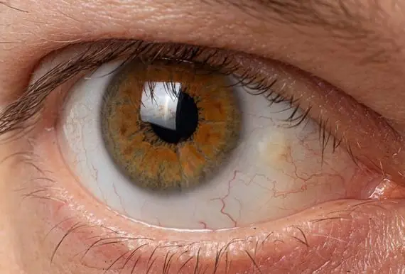 These are the first symptoms of a… See more