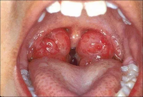 Doctors Reveal: 5 Subtle Signs That May Deserve a Closer Look
