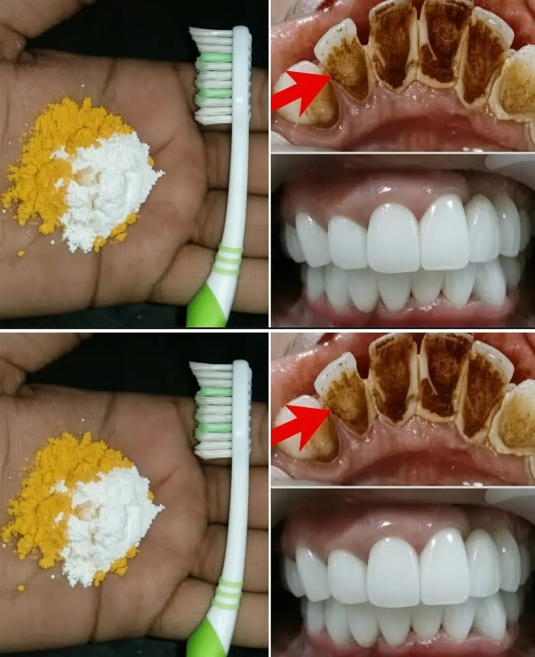 Home Teeth Whitening: Get Whiter Teeth in Just 2 Minutes!