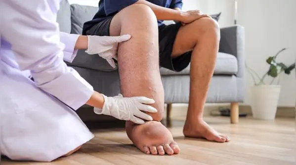 If you notice your legs are swollen, that’s a sign of ca…See more