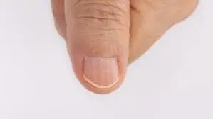 If You’re Over 40 and Notice These Nail Lines, Here’s What Experts Say You Should Know