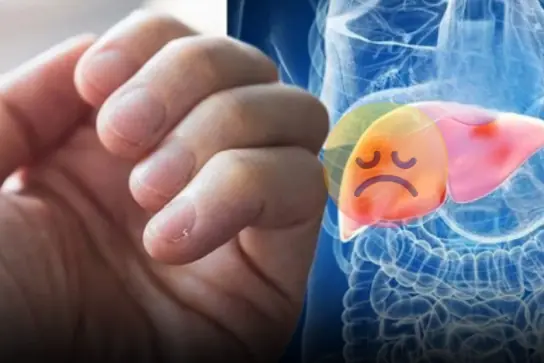 7 Subtle Signs of Diabetes That Often Go Unnoticed