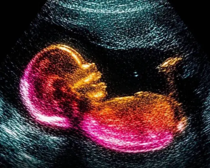 Scientists Just Found a Clue Behind Autism’s Development — This Can Change Everything
