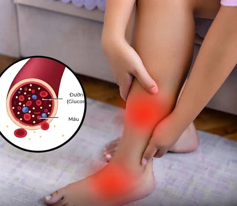 How to Recognize Low Bl00d Sugar: 12 Possible Warning Signs...