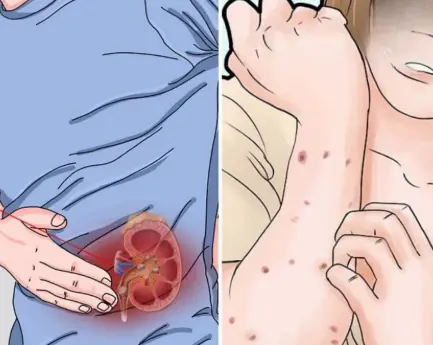 Your kidneys could be silently struggling 😨 Here are the signs to watch for and habits that may help protect them