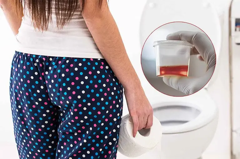 Your Morning Urine Could Offer Health Clues - 5 Signs to Watch For