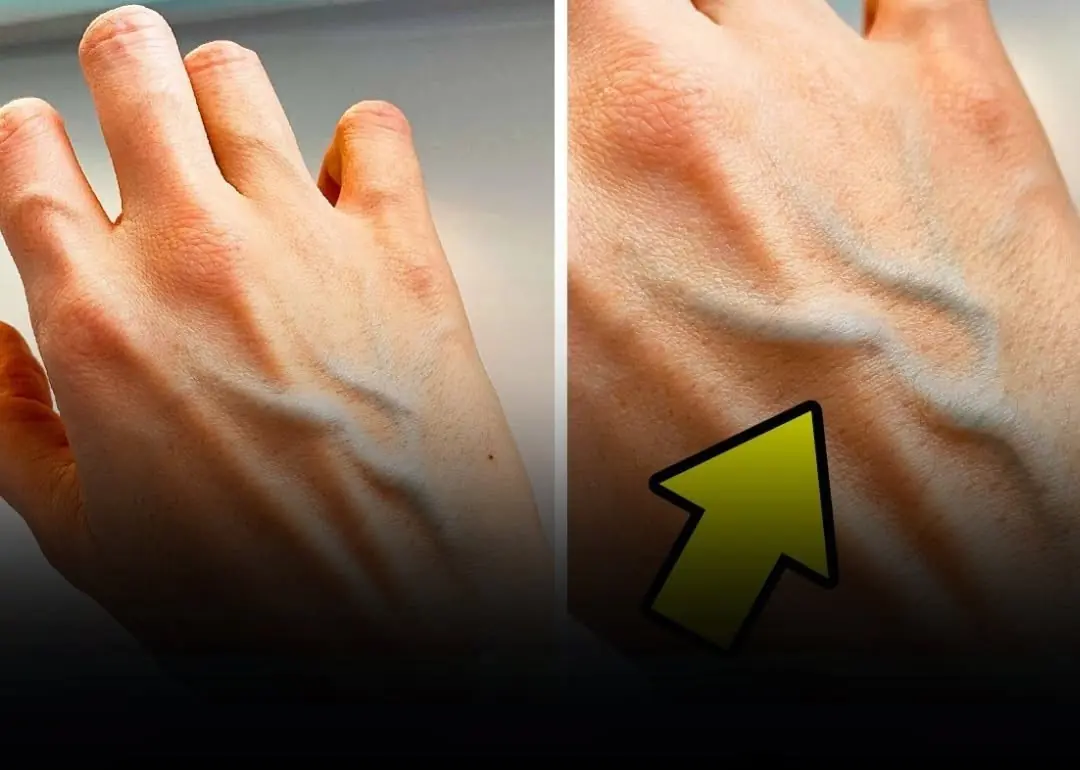 Your Veins May Be More Noticeable for Several Reasons — Some Worth Discussing With a Doctor