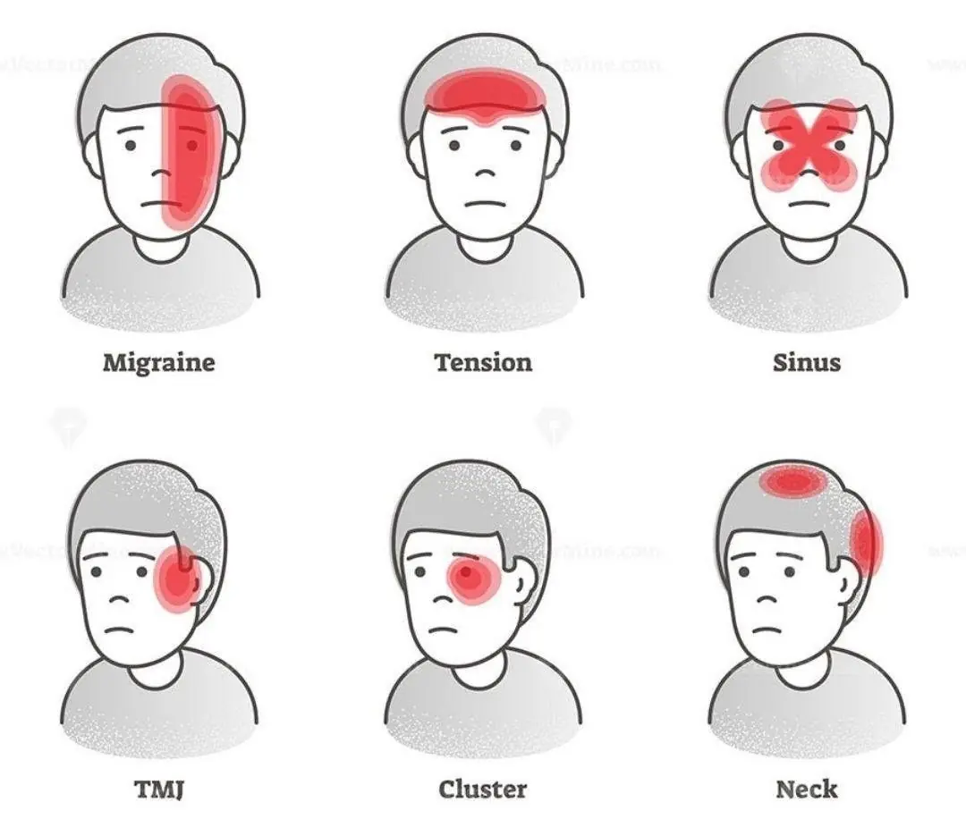 What Your Headache Pattern Could Be Trying to Tell You?