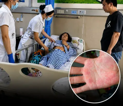 4 Changes in the Hands and Feet That May Signal Li.ver Problems, According to Doctors