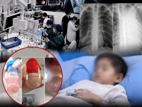 This frightening case shows how quickly a child's condition can deteriorate