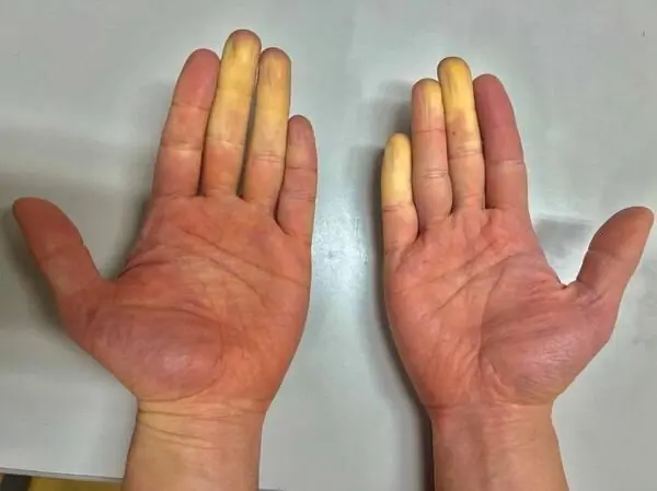 These are the consequences of sleeping with the… See more