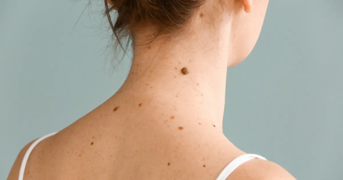 Small Bumps on Your Neck? Don’t Ignore Persistent Changes