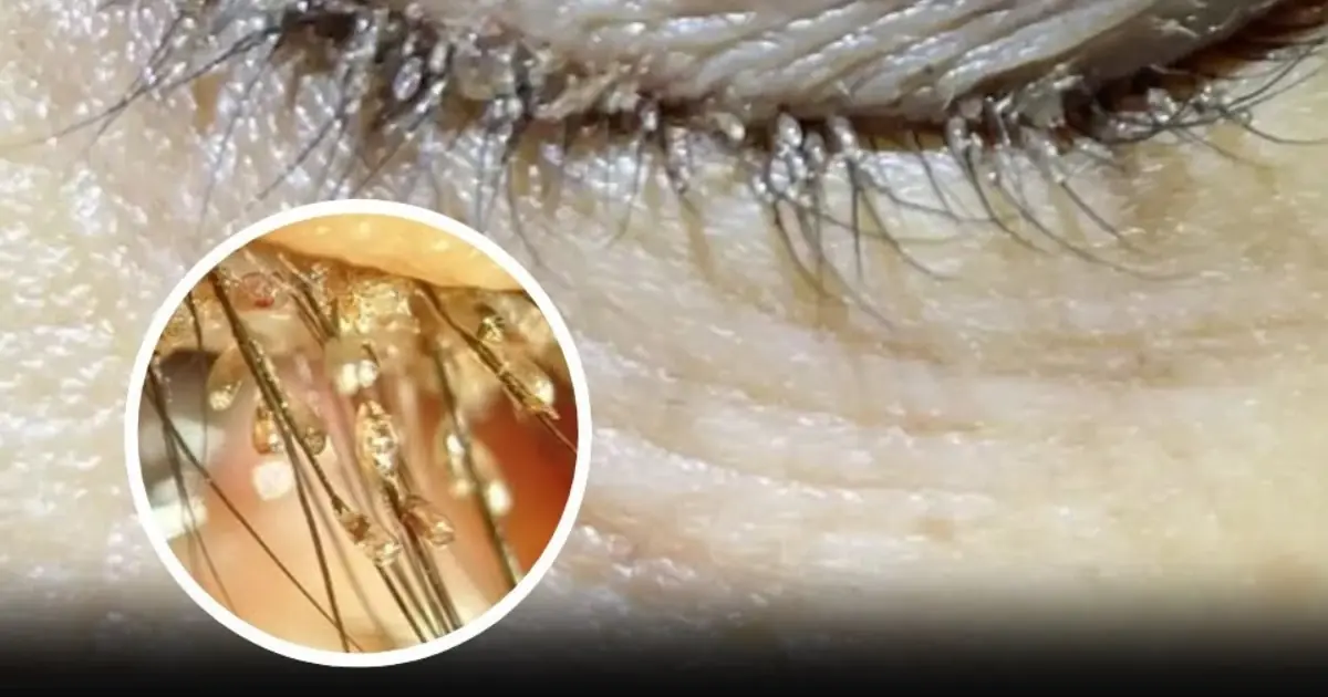 These are the consequences of sleeping with the… See more
