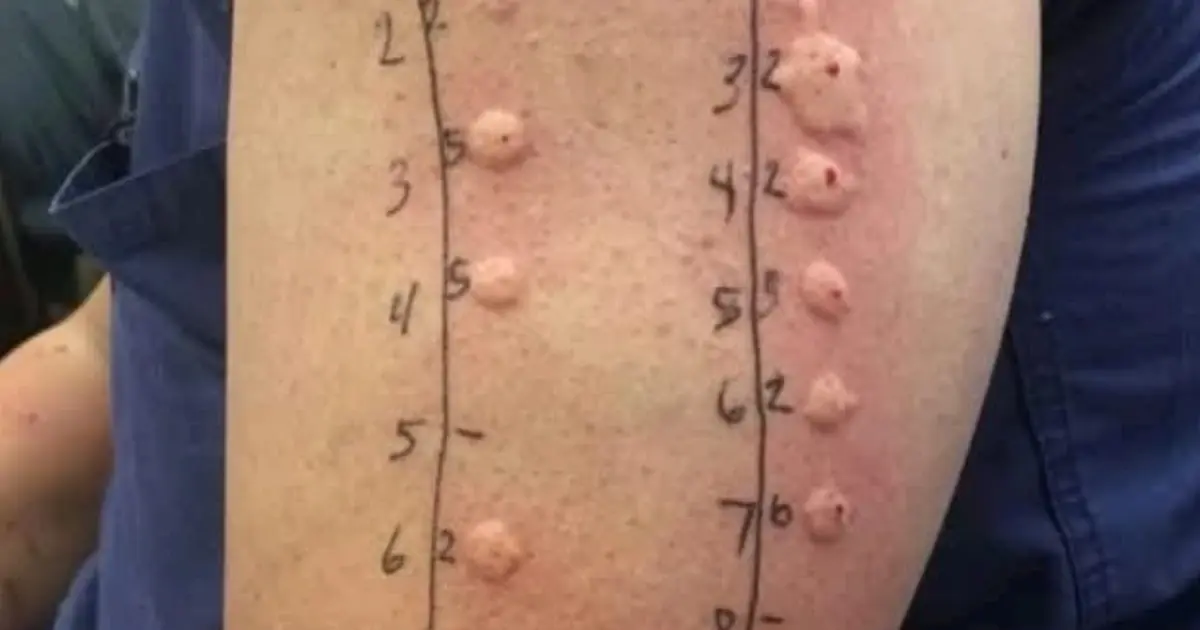 These are the consequences of sleeping with the… See more