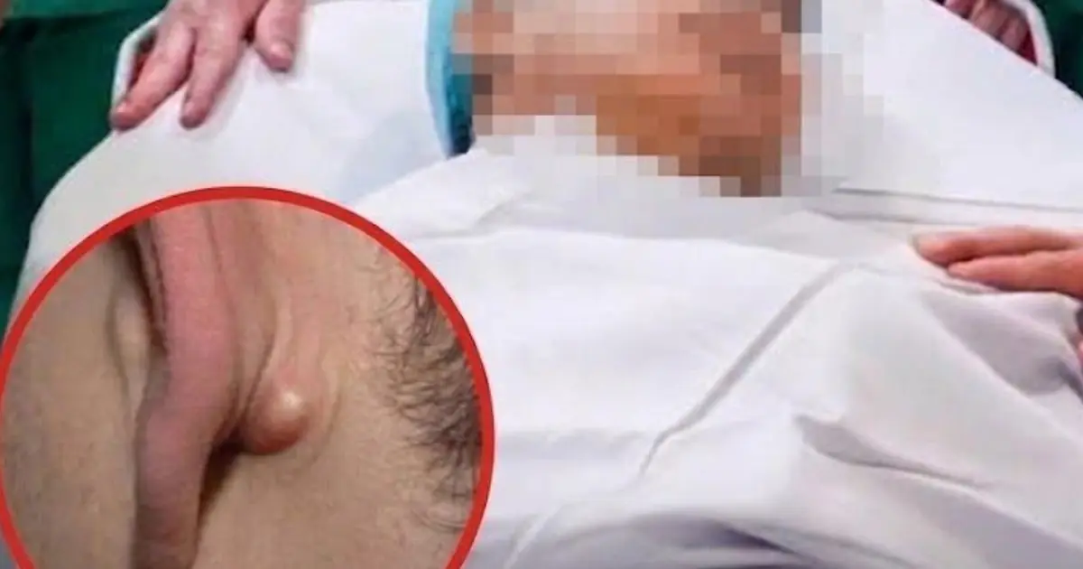 Young Man in His 20s D.i.es of C.anc.er After Ignoring Two Nighttime Symptoms