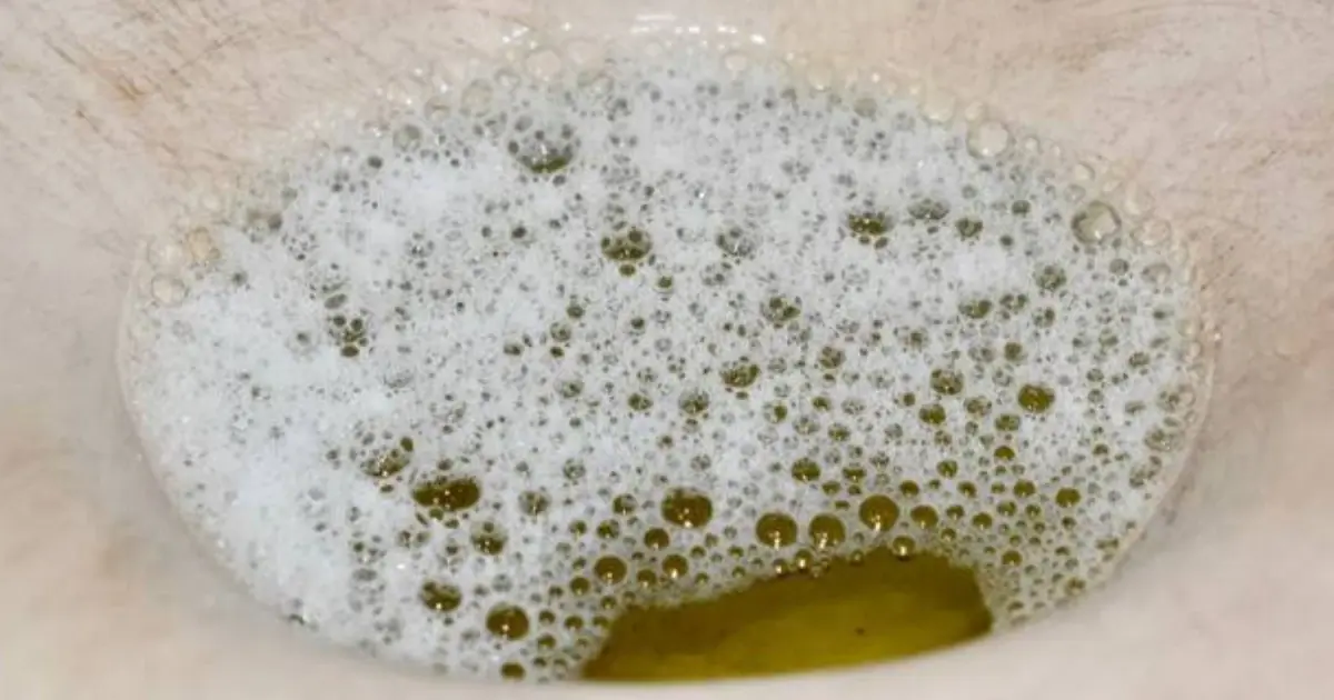 Bubbles in Your Urine? It Could Be Nothing — or Something Worth Checking