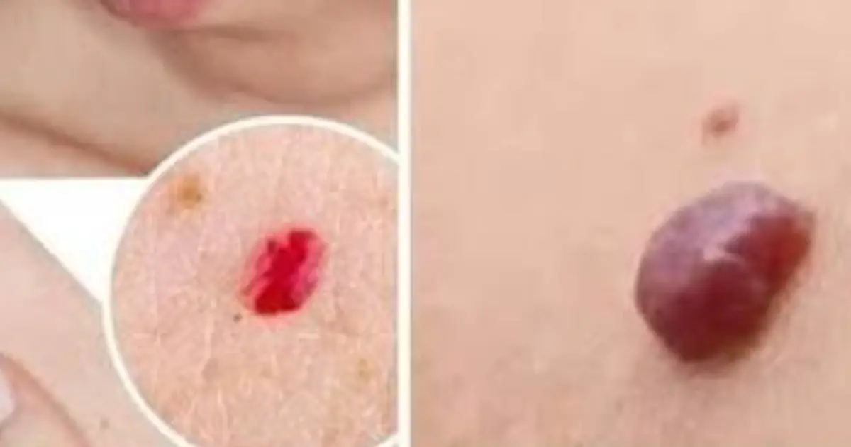 Tiny Red Dots on Your Skin? They Could Have Several Possible Causes…