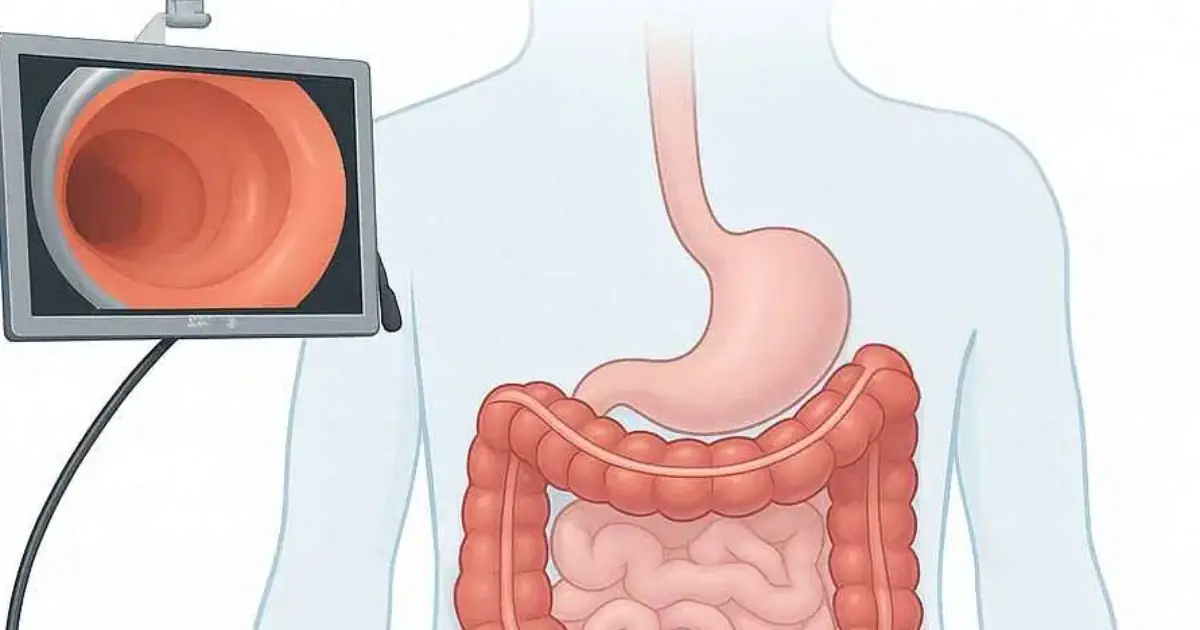 Before Scheduling a Colonoscopy, Make Sure You Ask This ONE Question