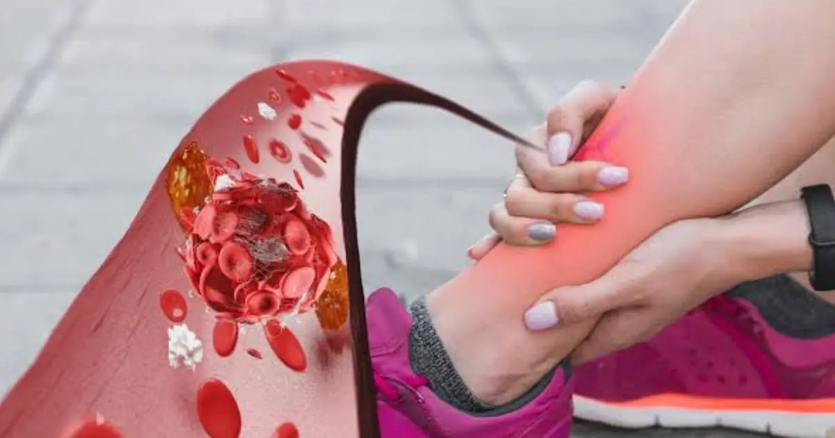 Poor Blood Flow? 6 Everyday Changes That May Help Support Circulation