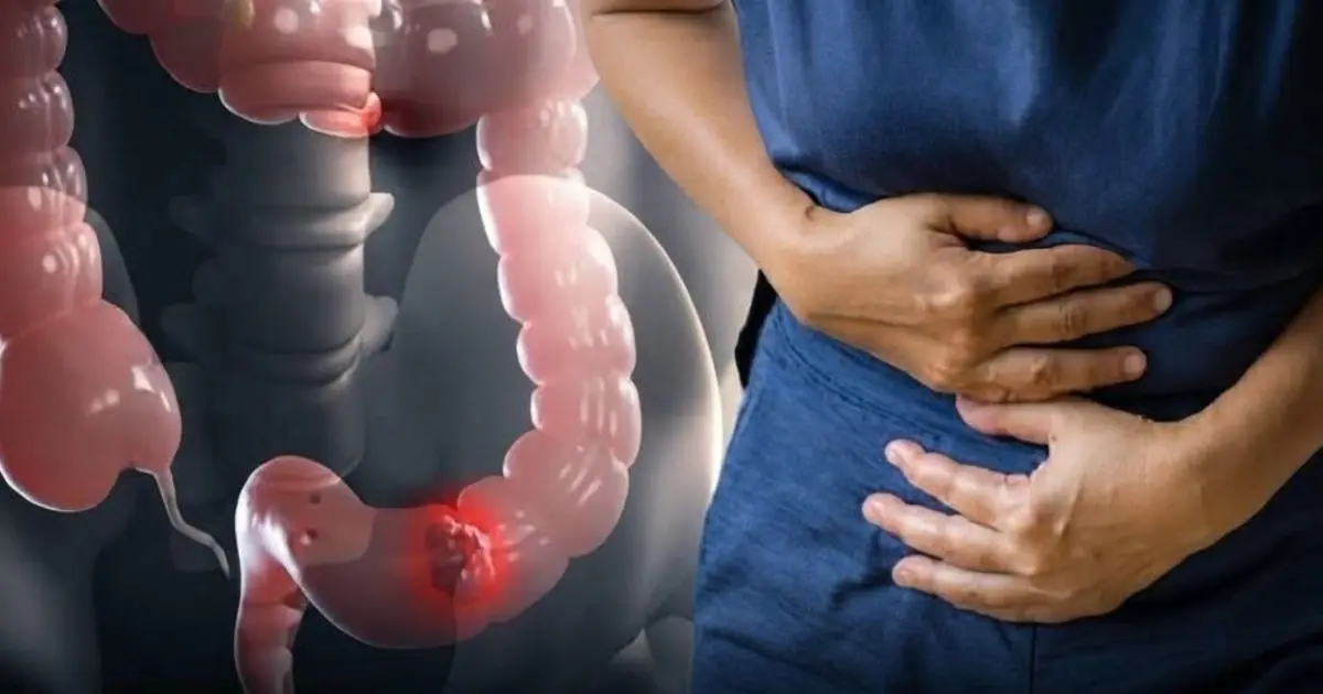 Could Your Diet Influence Can.cer Risk? Here Are 11 Foods to Know About...