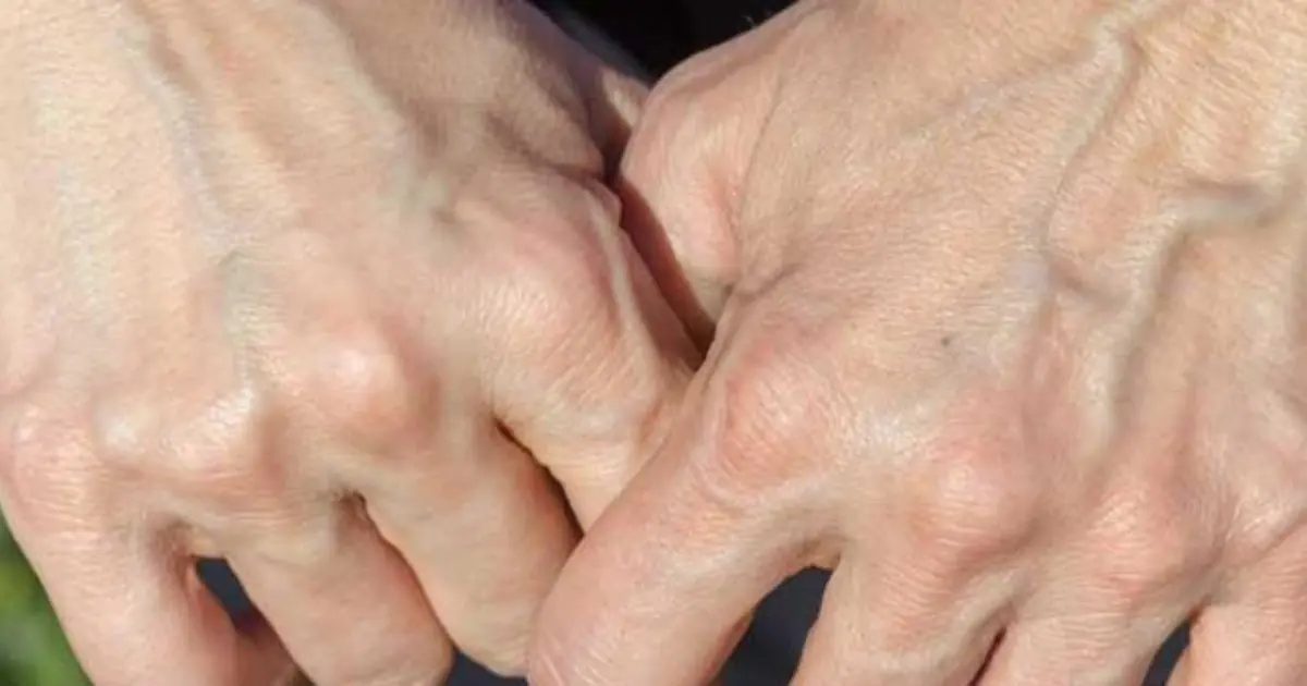 If you have visible veins, it means you are...
