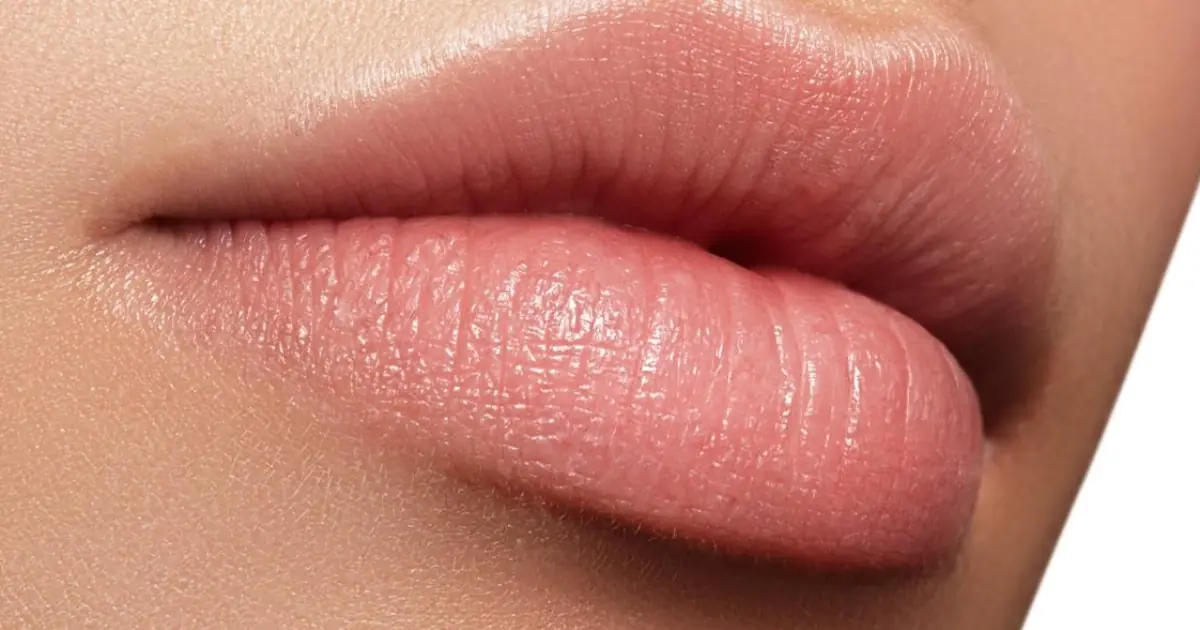 What Causes Unusual White Bumps on the Lips or Private Areas? Understanding Fordyce Spots