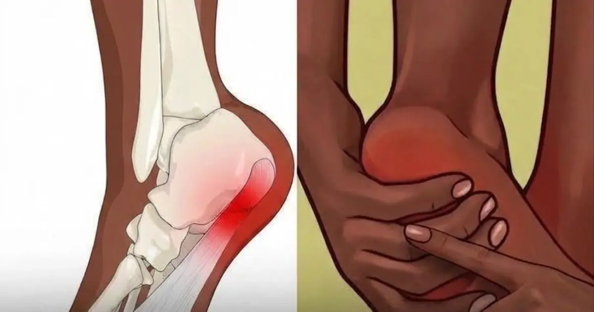 Heel pain in the morning or after standing too long could be a warning sign from your body...