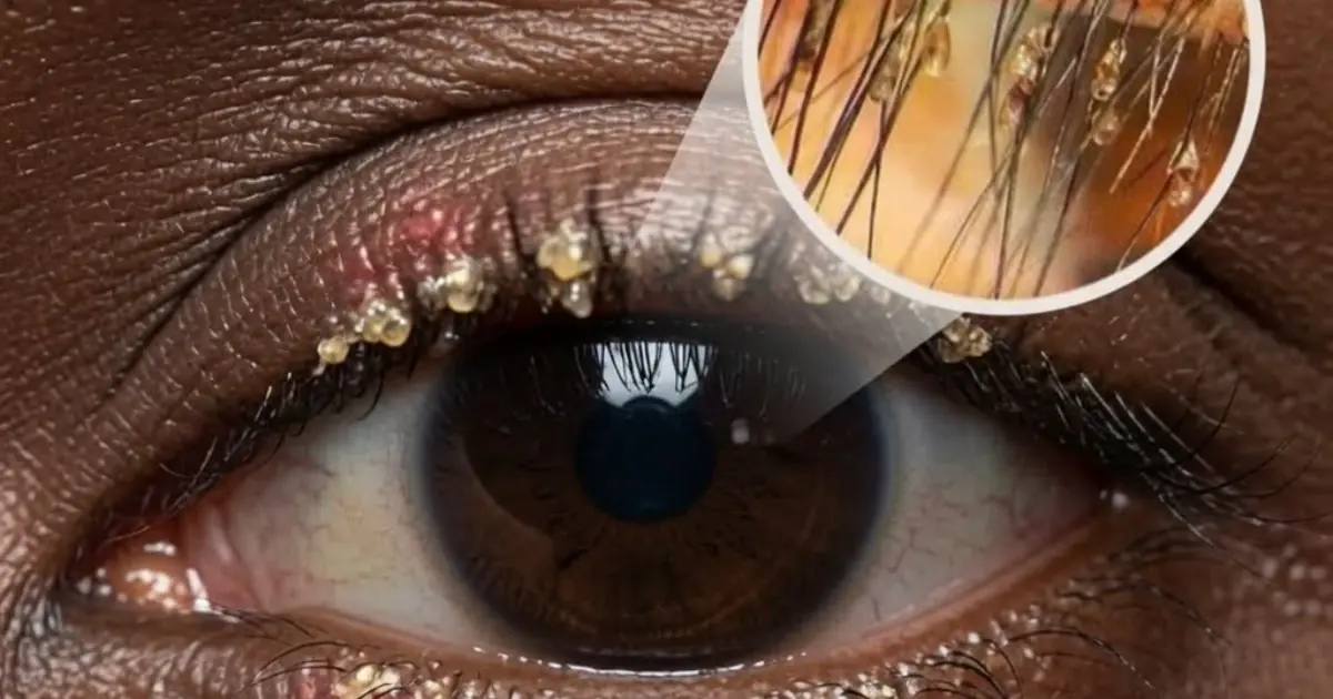Here are the consequences of sleeping with a… See more