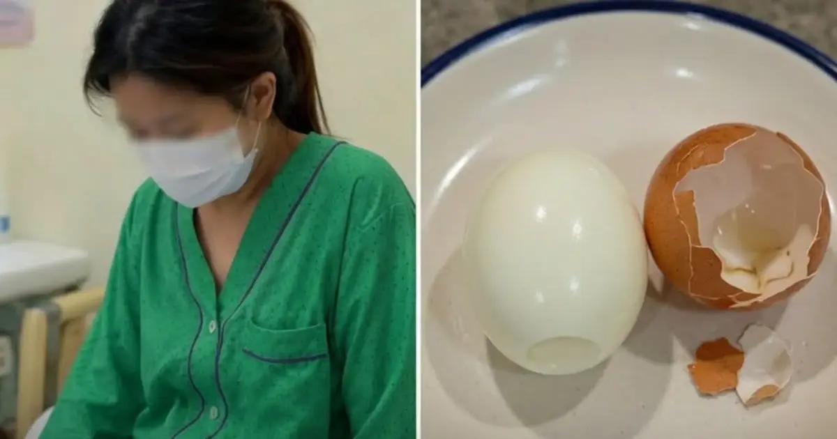 Trying to Lose Weight, She Ate Eggs at Every Meal for 5 Months. Her Medical Checkup Left Doctors Stunned