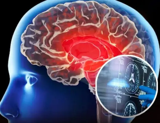 Your kidneys work quietly in the background every day