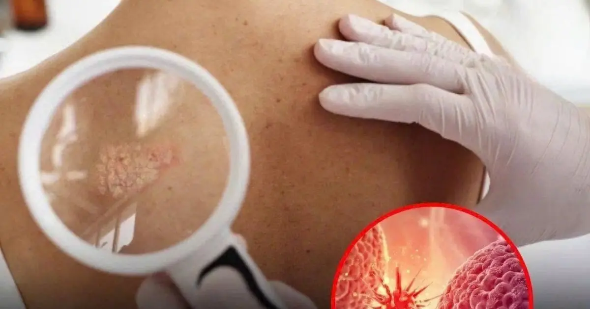 Don’t Ignore These 20 Early Warning Signs That Your Body Could Be Fighting Can:cer